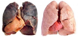 rokerslongen en gezond